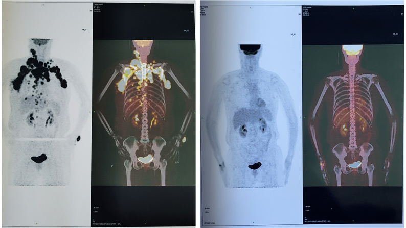 606516b8e99c4.jpg 606516b8e99c4.jpg