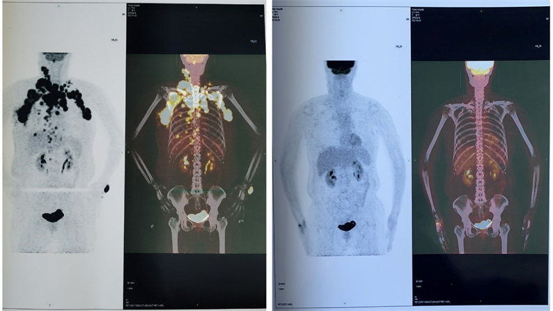 617bab4f38651.jpg 617bab4f38651.jpg