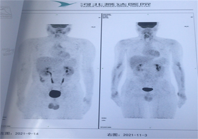 618ca73e752ff.png 618ca73e752ff.png